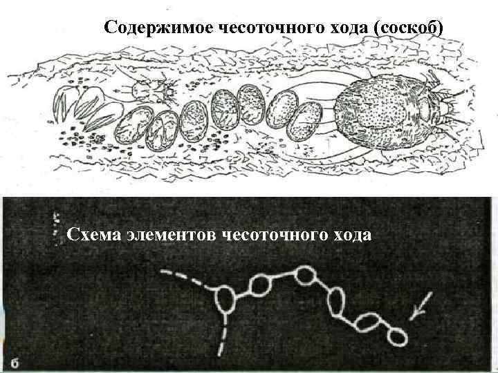 Содержимое чесоточного хода (соскоб) Схема элементов чесоточного хода 