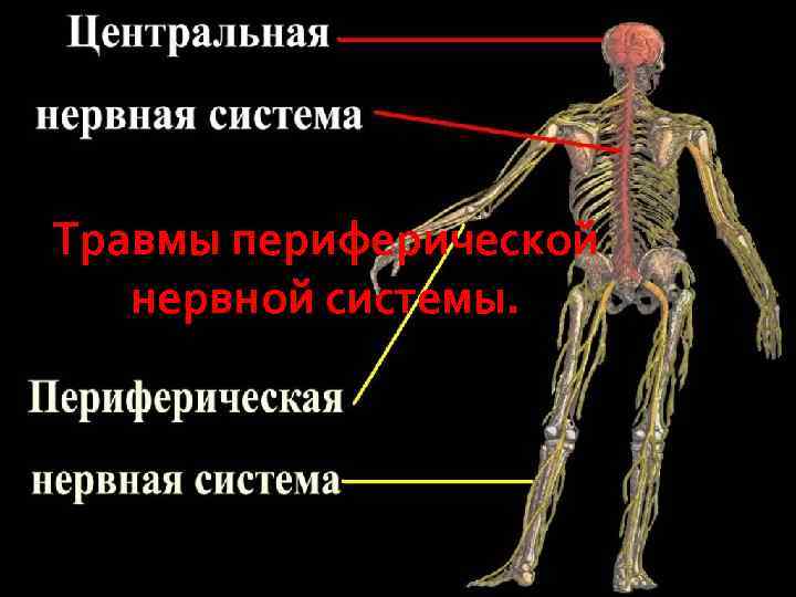 Травма нервной системы презентация