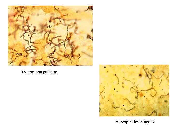 Treponema pallidum Leptospira interrogans 