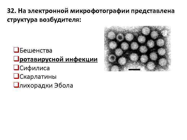 32. На электронной микрофотографии представлена структура возбудителя: q. Бешенства qротавирусной инфекции q. Сифилиса q.