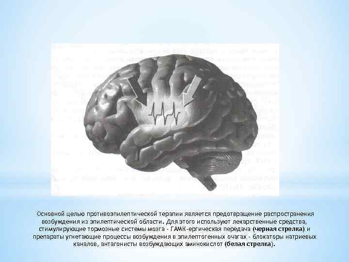 Основной целью противоэпилептической терапии является предотвращение распространения возбуждения из эпилептической области. Для этого используют