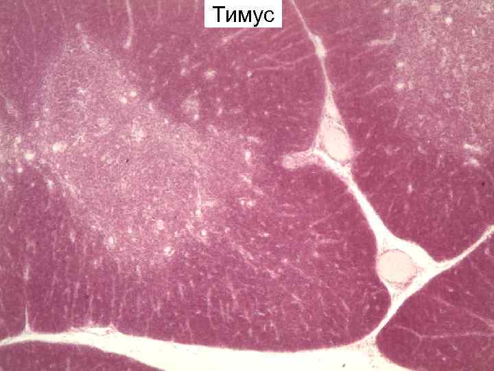 Тимус новорожденного гистология рисунок