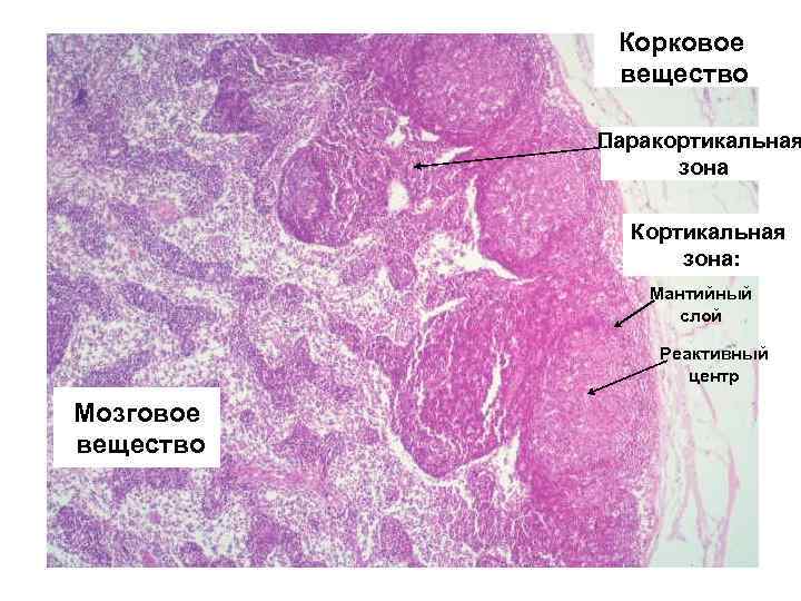 Корковое вещество Паракортикальная зона Кортикальная зона: Мантийный слой Реактивный центр Мозговое вещество 