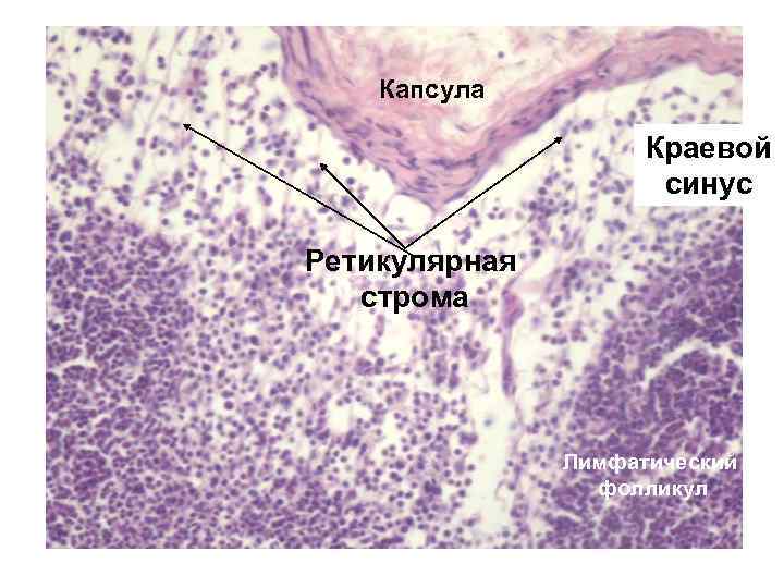 Капсула Краевой синус Ретикулярная строма Лимфатический фолликул 