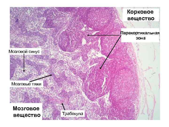 Корковое вещество Паракортикальная зона Мозговой синус Мозговые тяжи Мозговое вещество Трабекула 