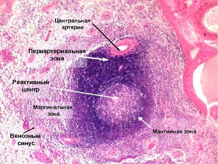 Центральная артерия Периартериальная зона Реактивный центр Маргинальная зона Венозный синус Мантийная зона 