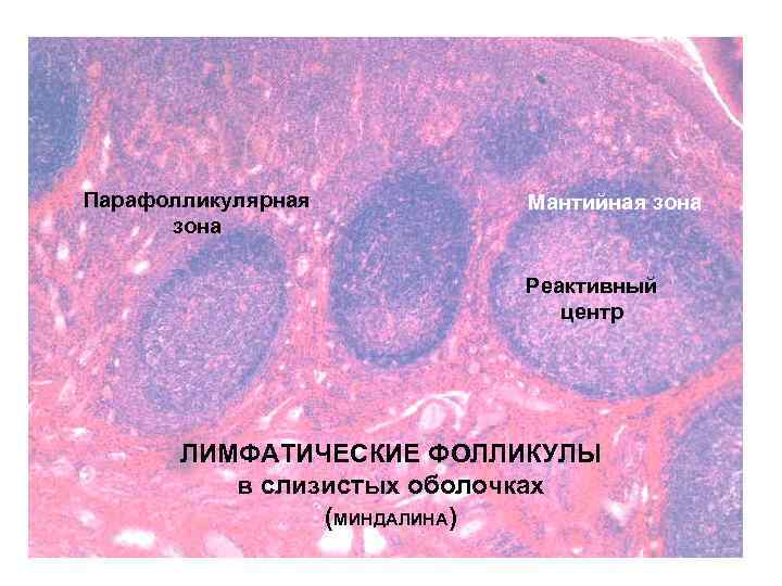 Парафолликулярная зона Мантийная зона Реактивный центр ЛИМФАТИЧЕСКИЕ ФОЛЛИКУЛЫ в слизистых оболочках (МИНДАЛИНА) 