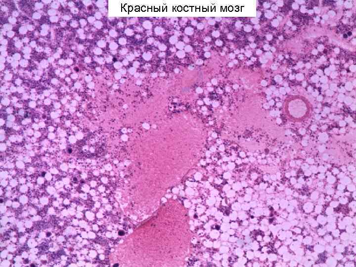 Красный мозг препарат. Костный мозг гистология препарат. Срез красного костного мозга гистология. Срез красного костного мозга препарат гистология. Красный костный мозг гистология препарат.