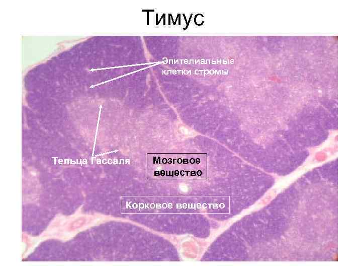 Тимус Корковое вещество Эпителиальные клетки стромы Мозговое вещество Тельца Гассаля Мозговое вещество Корковое вещество