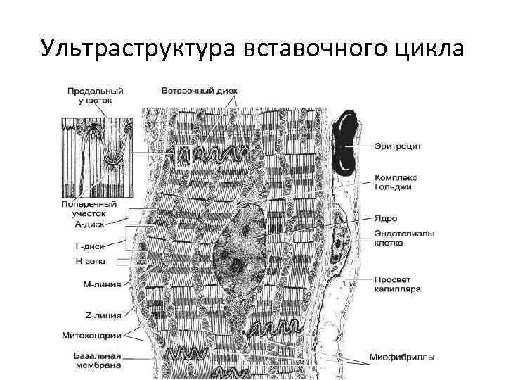 Схема вставочного диска - 89 фото