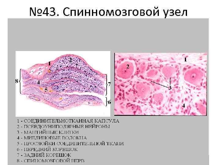 № 43. Спинномозговой узел 