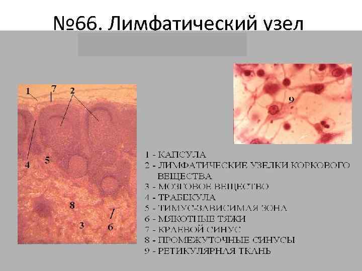 № 66. Лимфатический узел 