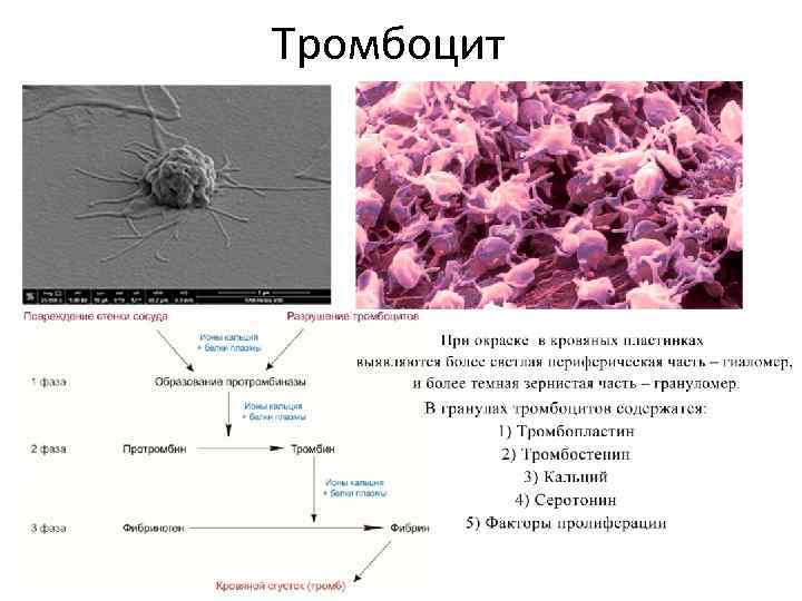 Тромбоцит 