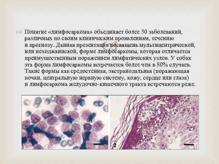  Понятие «лимфосаркома» объединяет более 30 заболеваний, различных по своим клиническим проявлениям, течению и