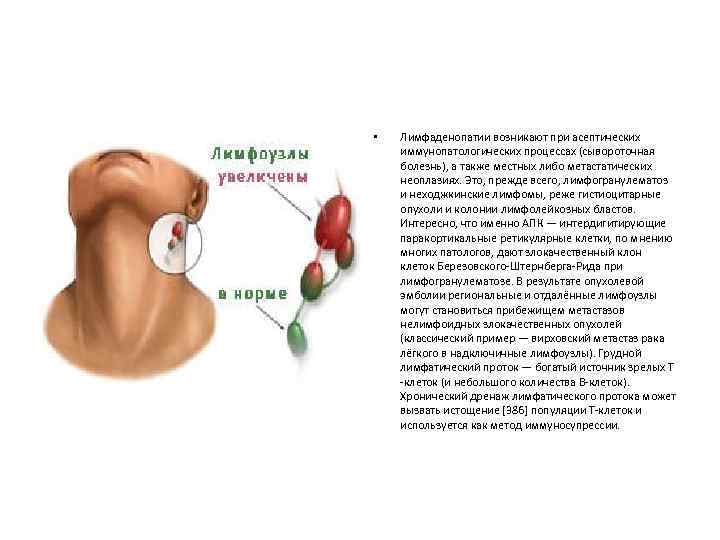 • Лимфаденопатии возникают при асептических иммунопатологических процессах (сывороточная болезнь), а также местных либо