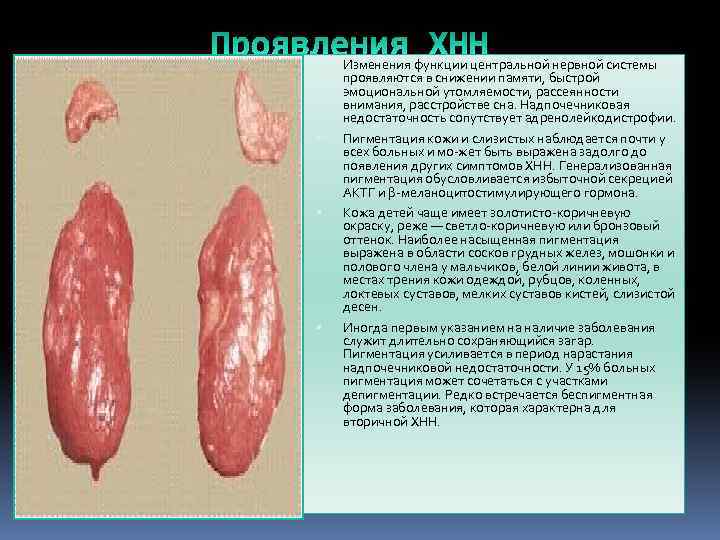  Изменения функции центральной нервной системы проявляются в снижении памяти, быстрой эмоциональной утомляемости, рассеянности