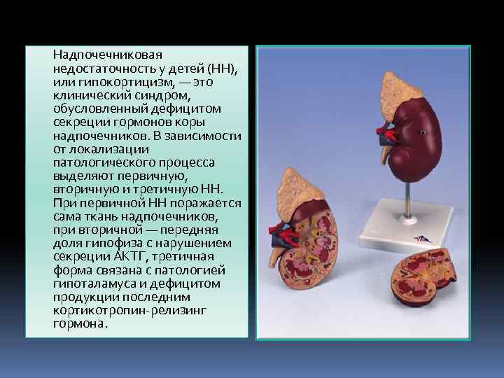 Надпочечниковая недостаточность картинки