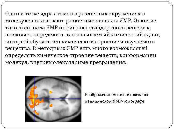 Одни и те же ядра атомов в различных окружениях в молекуле показывают различные сигналы