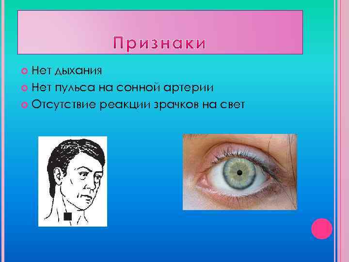 Зрачки не реагируют. Нет реакции зрачков на свет. Прямая реакция зрачка. Отсутствие реакции зрачка. Реакция зрачков при коме.