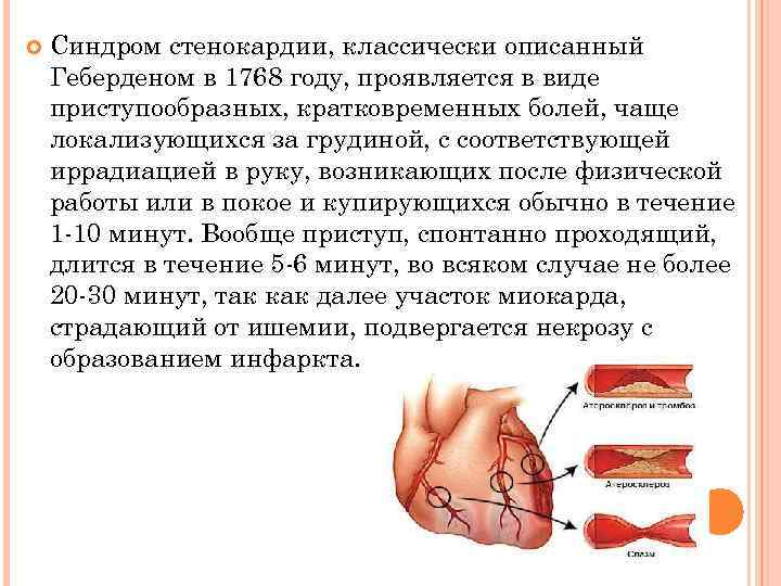  Синдром стенокардии, классически описанный Геберденом в 1768 году, проявляется в виде приступообразных, кратковременных