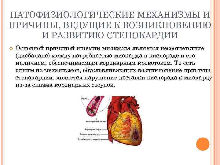 ПАТОФИЗИОЛОГИЧЕСКИЕ МЕХАНИЗМЫ И ПРИЧИНЫ, ВЕДУЩИЕ К ВОЗНИКНОВЕНИЮ И РАЗВИТИЮ СТЕНОКАРДИИ Основной причиной ишемии миокарда