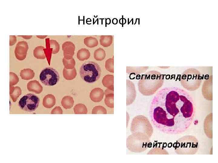 Сегментоядерные у женщин