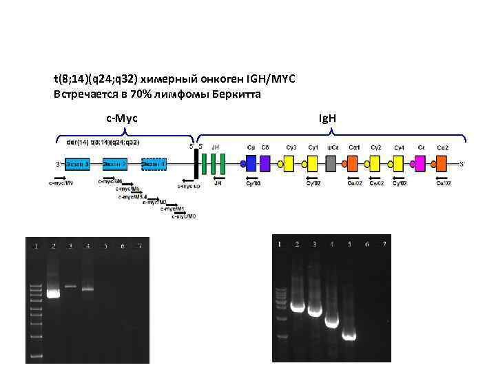 t(8; 14)(q 24; q 32) химерный онкоген IGH/MYC Встречается в 70% лимфомы Беркитта c-Myc