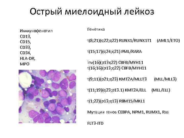 Острый миелоидный лейкоз Иммунофенотип CD 13, CD 15, CD 33, CD 34, HLA-DR, MPO