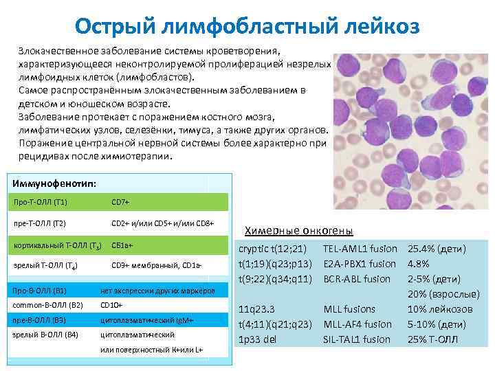 Острый лимфобластный лейкоз Злокачественное заболевание системы кроветворения, характеризующееся неконтролируемой пролиферацией незрелых лимфоидных клеток (лимфобластов).