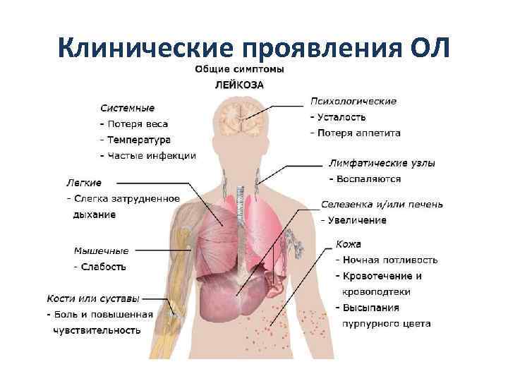 Клинические проявления ОЛ 