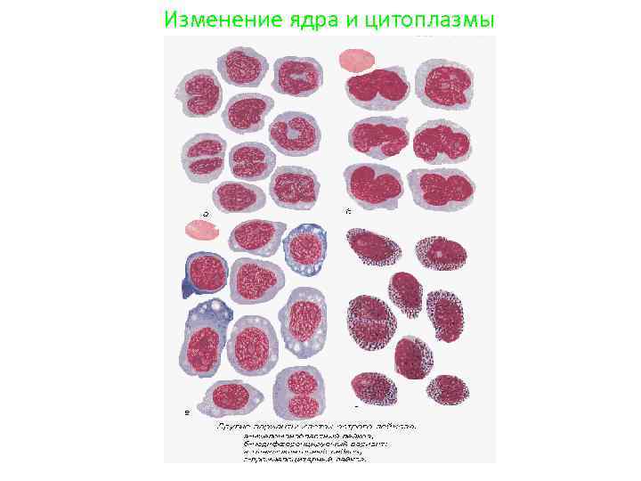 Изменение ядра и цитоплазмы 