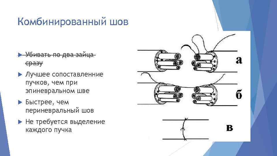 Комбинированный шов Убивать по два зайца сразу Лучшее сопоставленние пучков, чем при эпиневральном шве