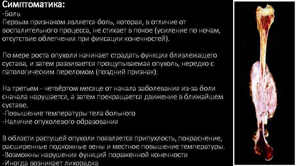 Симптоматика: -Боль Первым признаком является боль, которая, в отличие от воспалительного процесса, не стихает