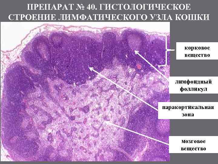 ПРЕПАРАТ № 40. ГИСТОЛОГИЧЕСКОЕ СТРОЕНИЕ ЛИМФАТИЧЕСКОГО УЗЛА КОШКИ корковое вещество лимфоидный фолликул паракортикальная зона