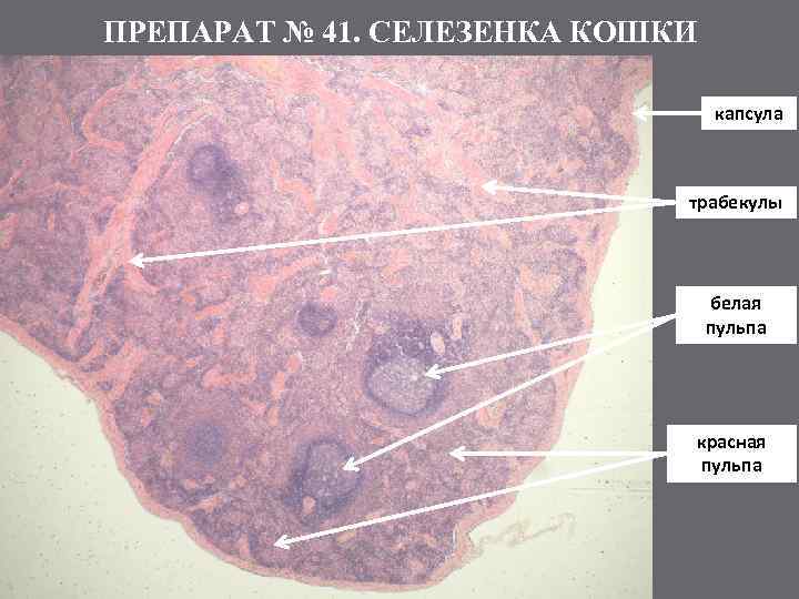 ПРЕПАРАТ № 41. СЕЛЕЗЕНКА КОШКИ капсула трабекулы белая пульпа красная пульпа 