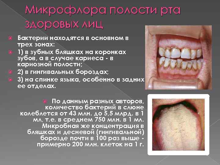 Микрофлора полости рта здоровых лиц Бактерии находятся в основном в трех зонах: 1) в