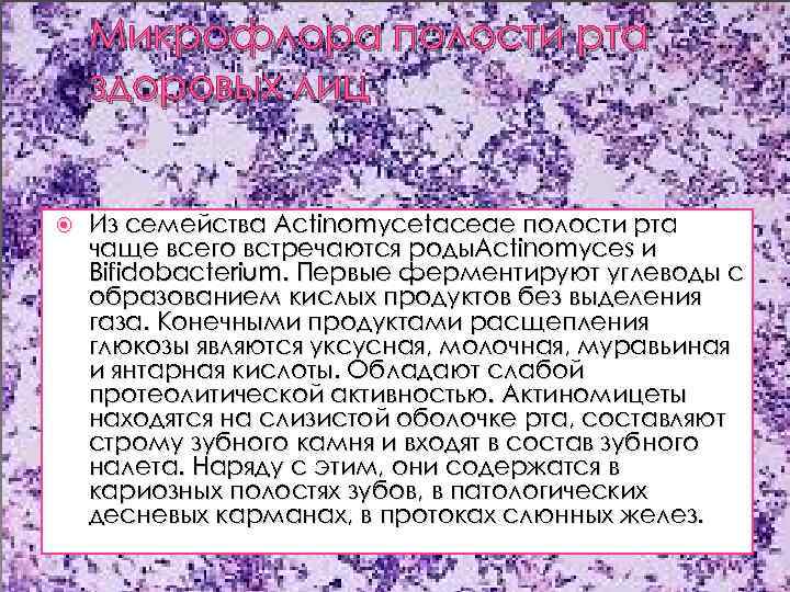 Микрофлора полости рта здоровых лиц Из семейства Actinomycetaceae полости рта чаще всего встречаются роды.