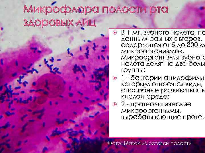 Микрофлора полости рта здоровых лиц В 1 мг. зубного налета, по данным разных авторов,