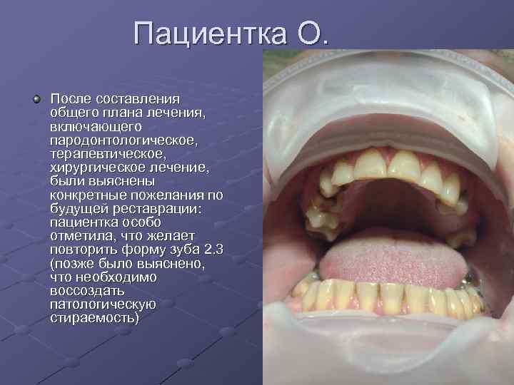 Пациентка О. После составления общего плана лечения, включающего пародонтологическое, терапевтическое, хирургическое лечение, были выяснены