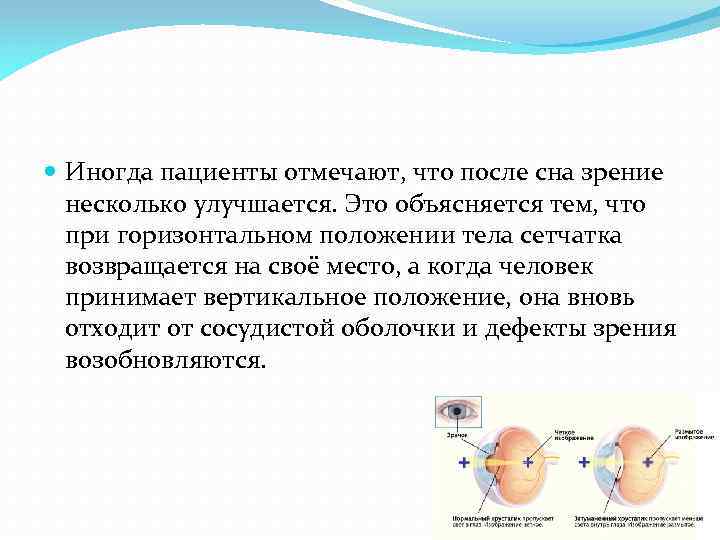  Иногда пациенты отмечают, что после сна зрение несколько улучшается. Это объясняется тем, что