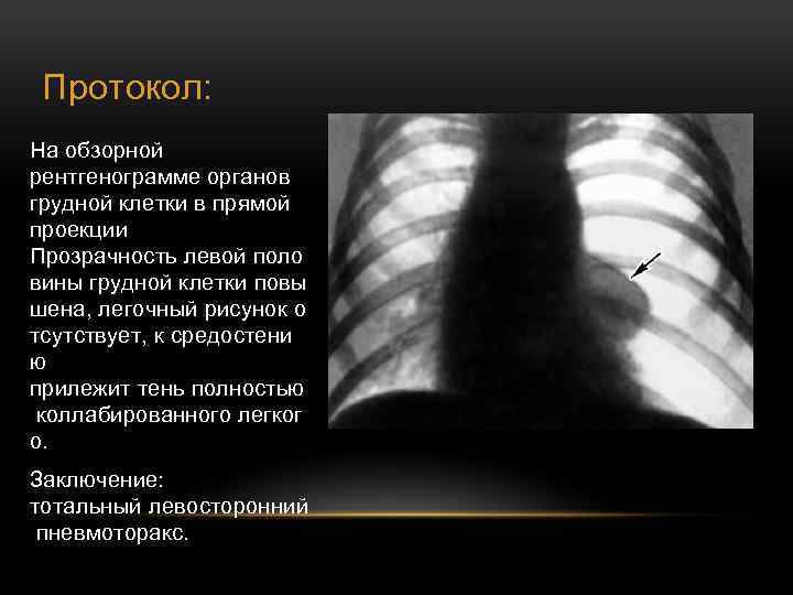 Изображение органов на рентгенограммах является ответ на тест