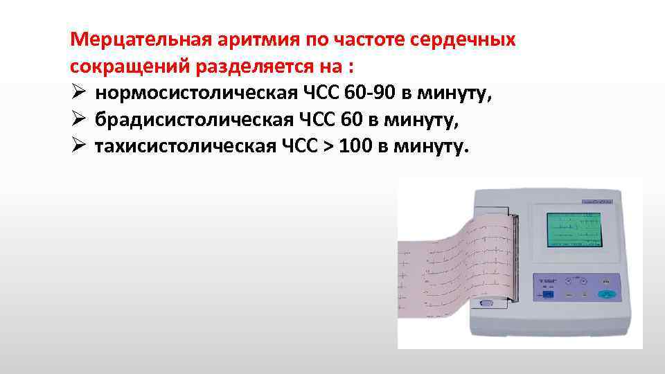 Мерцательная аритмия по частоте сердечных сокращений разделяется на : Ø нормосистолическая ЧСС 60 90