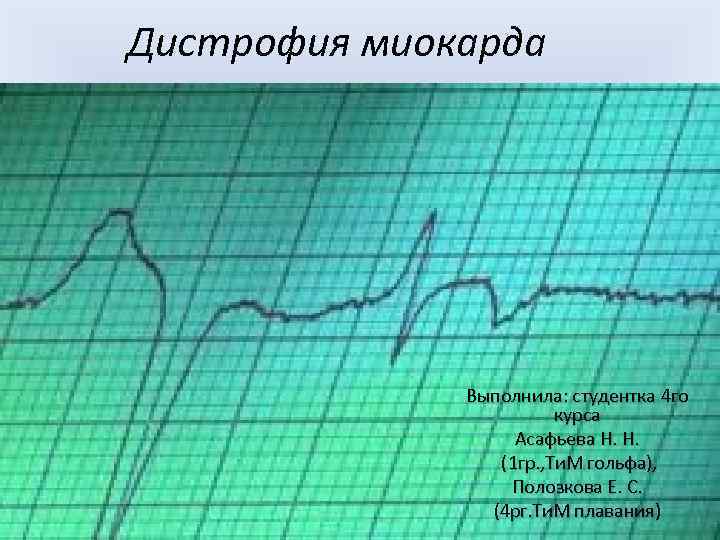 Дистрофия миокарда Выполнила: студентка 4 го курса Асафьева Н. Н. (1 гр. , Ти.