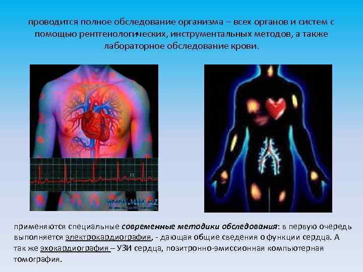 проводится полное обследование организма – всех органов и систем с помощью рентгенологических, инструментальных методов,