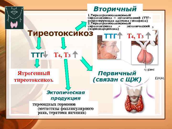 Экг при тиреотоксикозе картинки