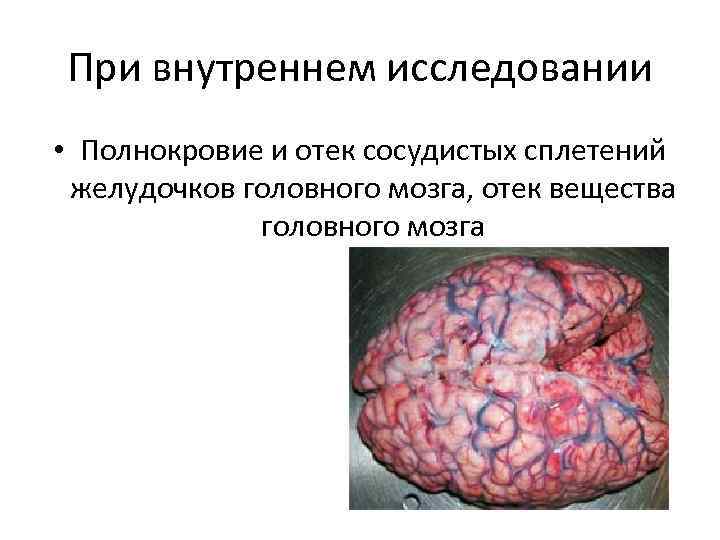 При внутреннем исследовании • Полнокровие и отек сосудистых сплетений желудочков головного мозга, отек вещества