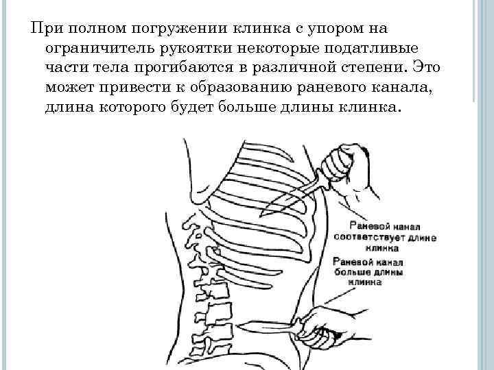 При полном погружении клинка с упором на ограничитель рукоятки некоторые податливые части тела прогибаются