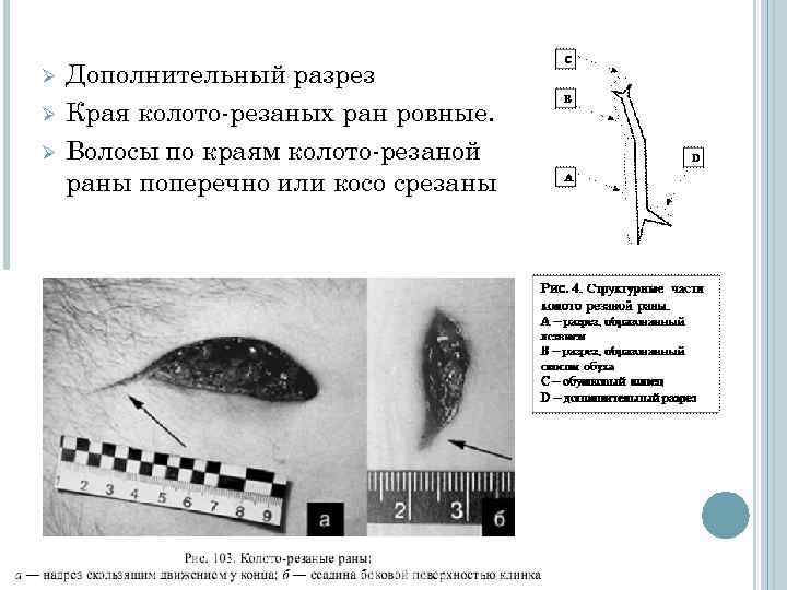 Ø Ø Ø Дополнительный разрез Края колото-резаных ран ровные. Волосы по краям колото-резаной раны