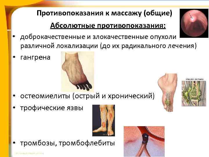 Противопоказания к массажу (общие) Абсолютные противопоказания: • доброкачественные и злокачественные опухоли различной локализации (до