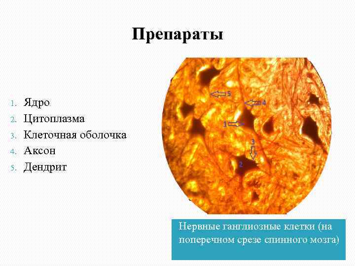 Препараты 1. 2. 3. 4. 5. Ядро Цитоплазма Клеточная оболочка Аксон Дендрит Нервные ганглиозные